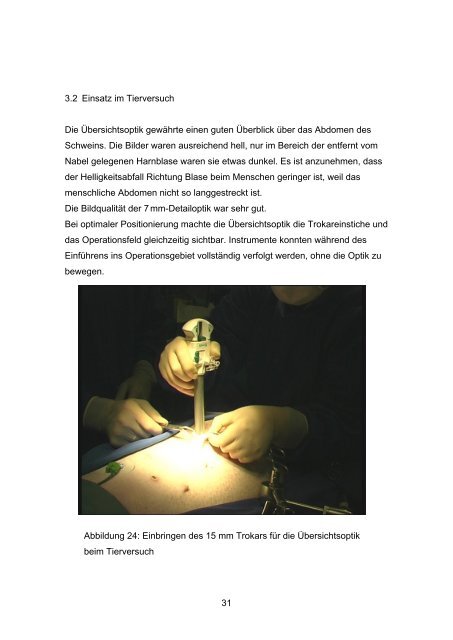 Die Übersichtsoptik - Experimentelle Minimal Invasive Chirurgie und ...