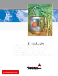 Sinuskopie