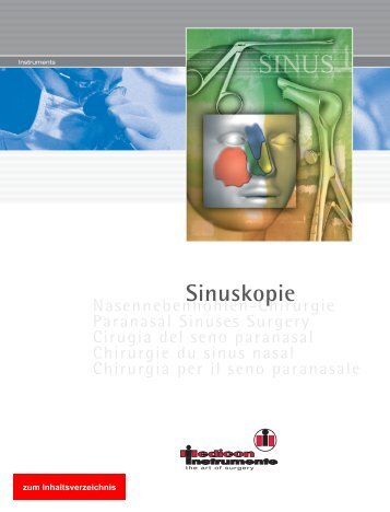 Sinuskopie