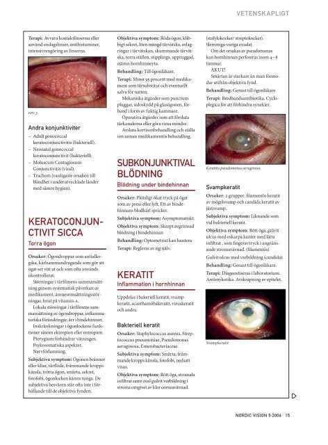 Nordic Vision - nr 5 2006 - Sveriges Kontaktlinsförening