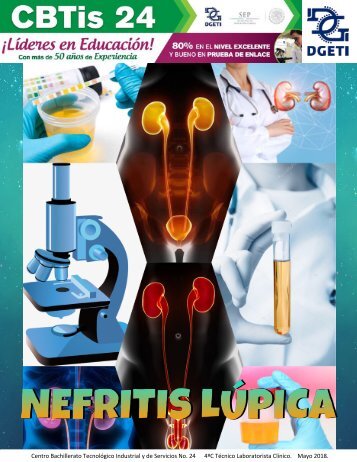 REVISTA NEFRITIS LUPICA-1