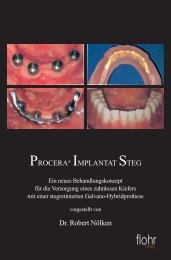 PROCERA® IMPLANTAT STEG Dr. Robert Nölken