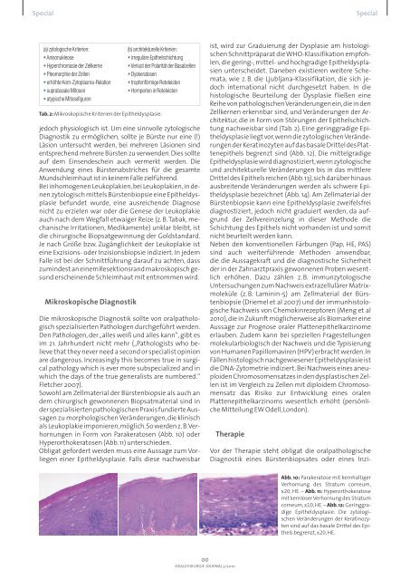 Die Leukoplakie der Mundschleimhaut: Diagnostik ... - Akopom