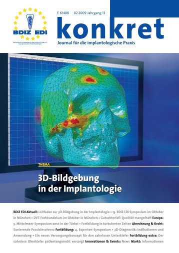 3D-Bildgebung in der Implantologie - BdiZ