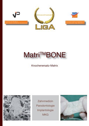 Matri™BONE - Champions-Implants