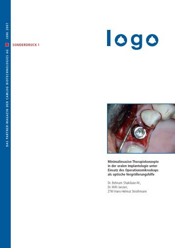 Minimalinvasive Therapiekonzepte in der oralen Implantologie unter ...