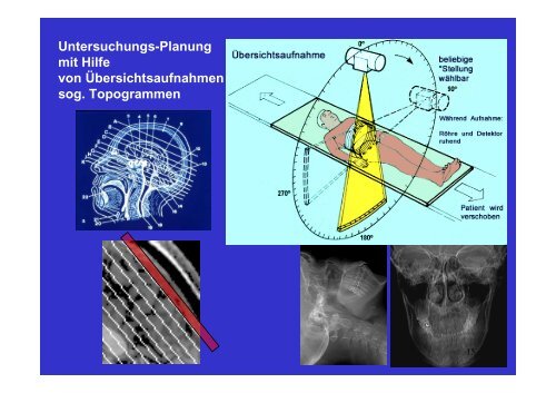 Download - Vorlesung CT Indikation