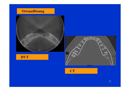 Download - Vorlesung CT Indikation