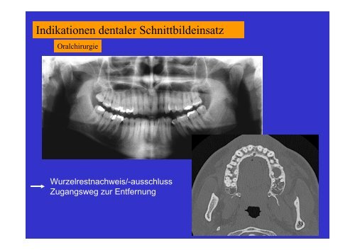 Download - Vorlesung CT Indikation