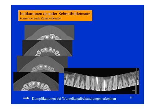 Download - Vorlesung CT Indikation