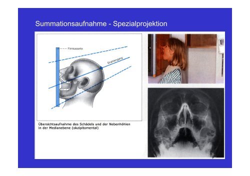 Download - Vorlesung CT Indikation