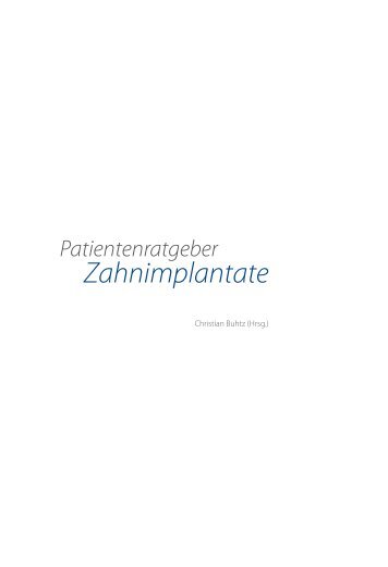 Implantate - Dr. Buhtz