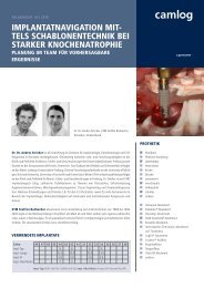 TelS SchAblonenTechnIk beI STARkeR ... - Alltec Dental