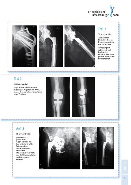 Jahresbericht 2008 - Klinik für Orthopädie und Unfallchirurgie der ...