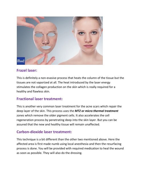 Laser Acne Scar Removal | Scar Marks Removal