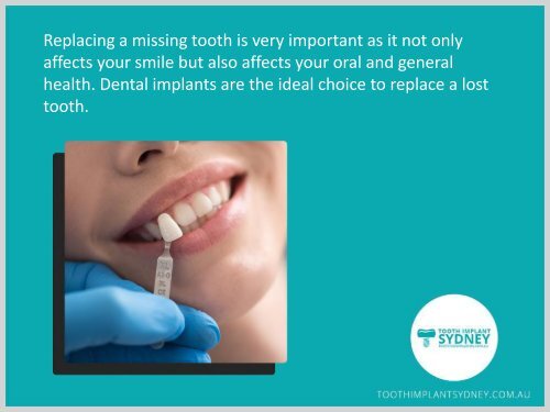 Lost a Tooth? No worries, Replace It with Dental Implants!