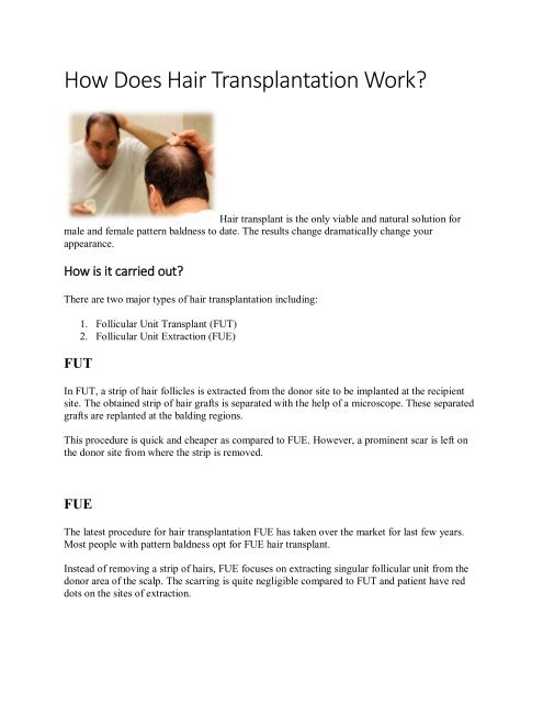 Hair Transplant Dubai