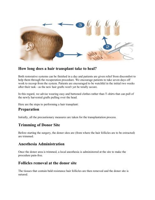 Hair Transplant Dubai