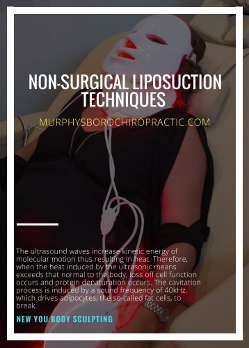 Non-surgical liposuction techniques- murphysborochiropractic.com