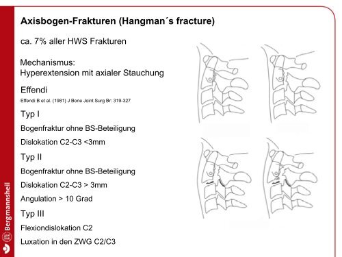 Axisbogen-Frakturen