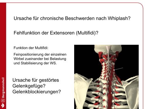 Axisbogen-Frakturen