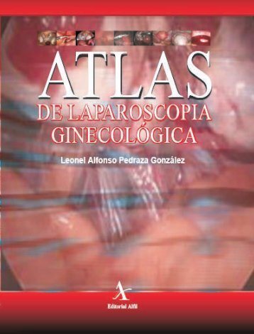 Atlas de laparoscopia ginecologica