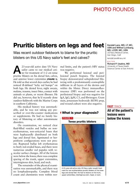 Pruritic blisters on legs and feet - The Journal of Family Practice