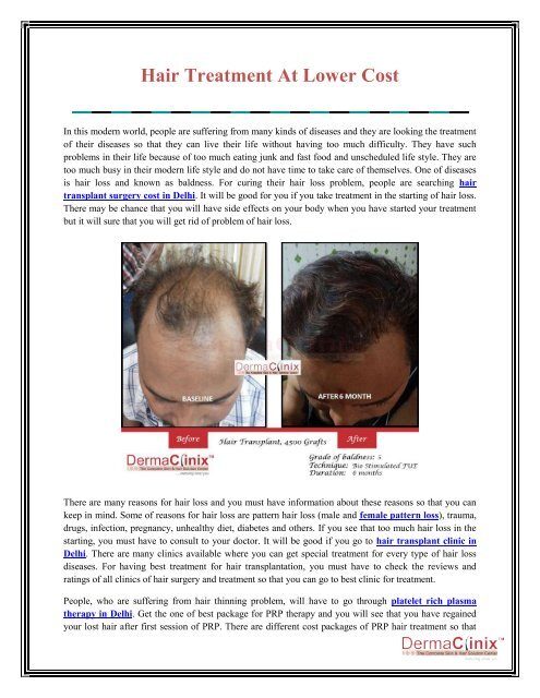 Hair Treatment At Lower Cost Hair Treatment At Lower Cost