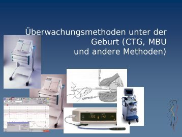 Überwachungsmethoden unter der Geburt (CTG, MBU und andere ...