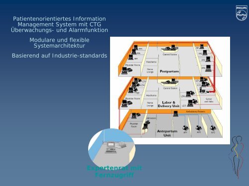 Überwachungsmethoden unter der Geburt (CTG, MBU und andere ...