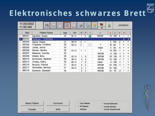 Überwachungsmethoden unter der Geburt (CTG, MBU und andere ...