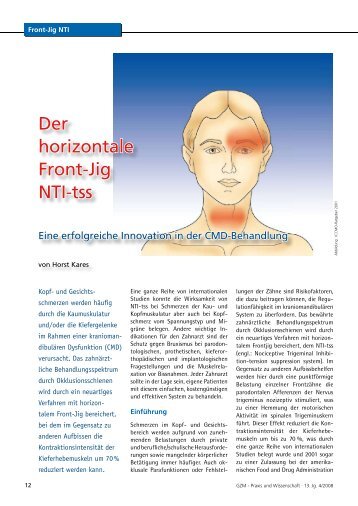 Der horizontale Front-Jig NTI-tss - Zantomed