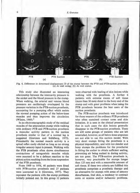 Prosthetics and Orthotics