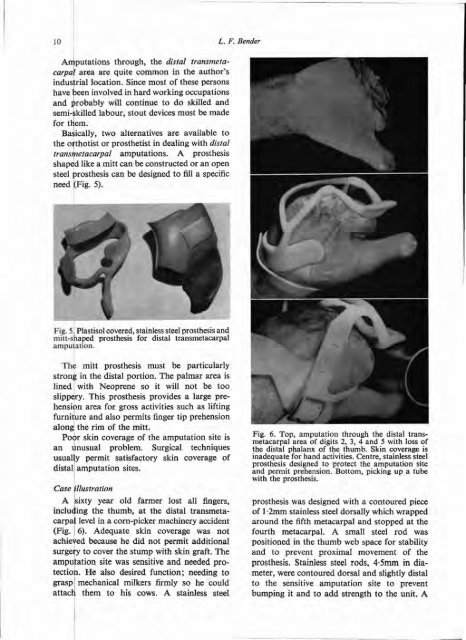 Prosthetics and Orthotics