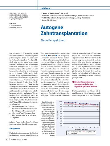Autogenous tooth transplantation - MKG-Praxisklinik Dr. Dr. Robert ...