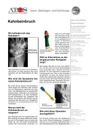 Kahnbeinbruch - und Fußchirurgie