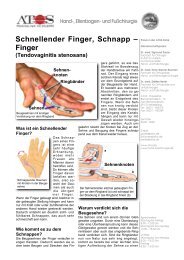 Schnellender Finger, Schnapp – Finger - und Fußchirurgie