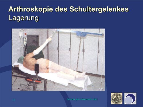 Schulterluxation - Praxisklinik für Unfallchirurgie und Orthopädie ...