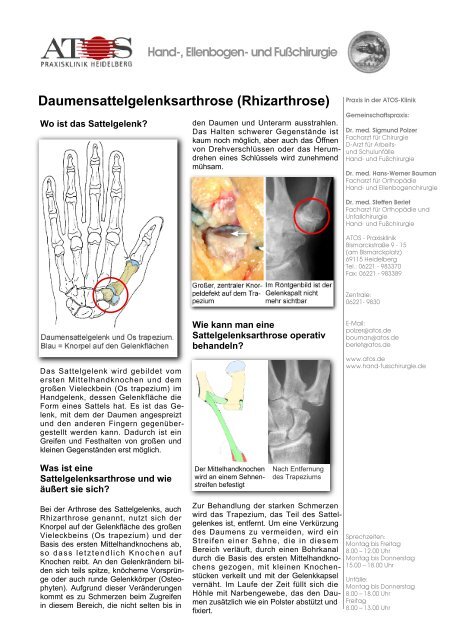 Daumensattelgelenksarthrose (Rhizarthrose) - und Fußchirurgie