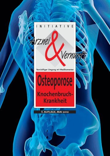 8. management der osteoporose im kindes- und jugendalter