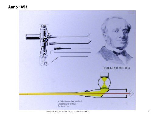 Flexible Endoskope mit Glasfaser-Bildbündel