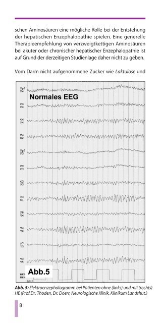 LEBERKOMA Hepatische Enzephalopathie - Gastro Liga