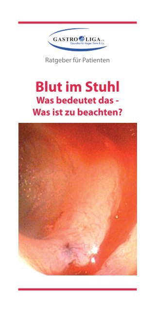 GASTROLIGA-Blut im Stuhl-09