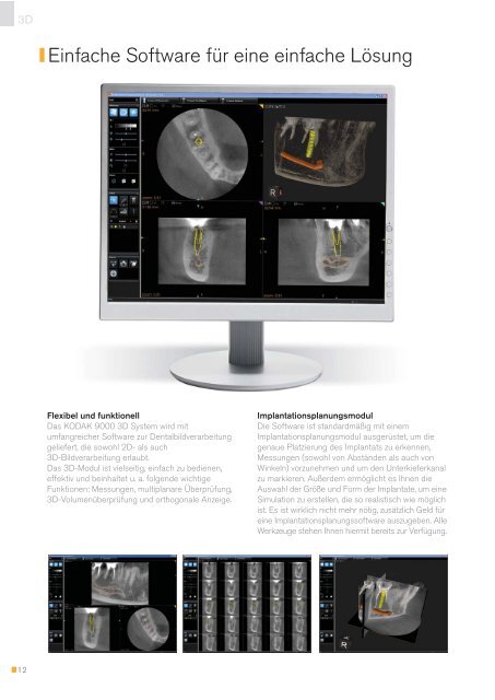 De / CS 9000 Prospekt (PDF 1.7 MB)