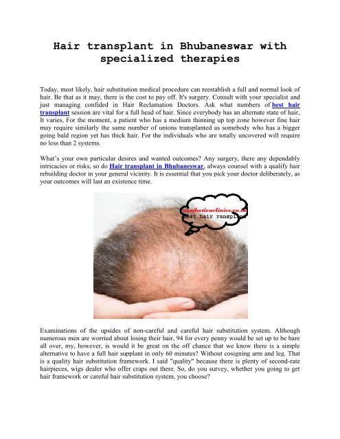 Hair transplant in Bhubaneswar with specialized therapies