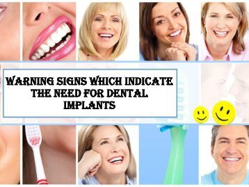 When You Need for Dental Implants