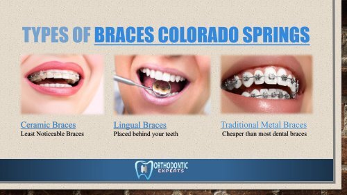 Best Orthodontist in Colorado Springs
