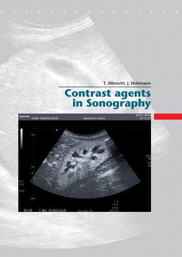 „Contrast Agents in Sonography“ by T - European-Hospital