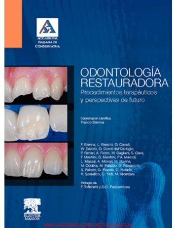 Odontología restauradora - Brenna @somosodonto