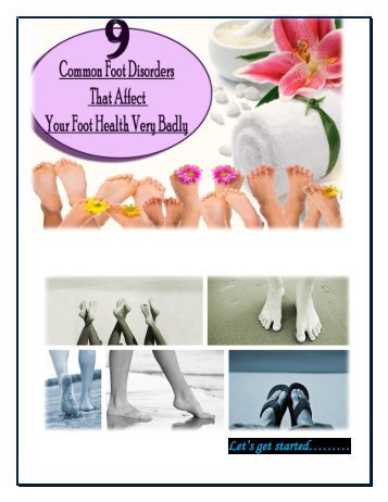 9 Common Foot Disorders That Affect Your Foot Health Very Badly
